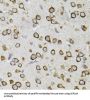 Centrosomal Protein 164 kDa (CEP164) Antibody