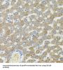 Centrosomal Protein 164 kDa (CEP164) Antibody