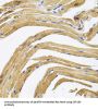 Centrosomal Protein 164 kDa (CEP164) Antibody
