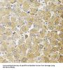 Centrosomal Protein 164 kDa (CEP164) Antibody