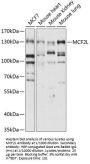 Guanine Nucleotide Exchange Factor DBS (MCF2L) Antibody