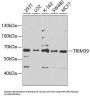 E3 Ubiquitin-Protein Ligase TRIM39 (TRIM39) Antibody