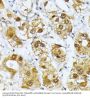 Ras-Related GTP-Binding Protein D (RRAGD) Antibody