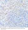 Ubiquinol-Cytochrome-C Reductase Complex Assembly Factor 2 (UQCC2) Antibody