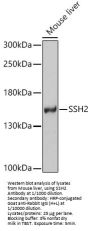Slingshot Homolog 2 (SSH2) Antibody