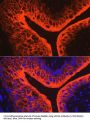 Uroplakin 3A (UPK3A) Antibody