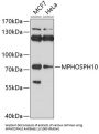 U3 Small Nucleolar Ribonucleoprotein Protein MPP10 (MPHOSPH10) Antibody