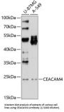 Carcinoembryonic Antigen Related Cell Adhesion Molecule 4 (CEACAM4) Antibody