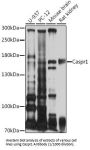 Contactin Associated Protein 1 (CNTNAP1) Antibody