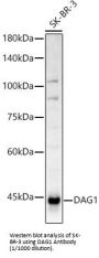 Dystroglycan (DAG1) Antibody