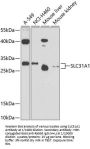 Solute Carrier Family 31 (Copper Transporters), Member 1 (SLC31A1) Antibody