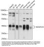 NADH Ubiquinone Oxidoreductase Subunit A10 (NDUFA10) Antibody