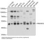 Protein Kinase cAMP-Dependent Type I Regulatory Subunit Beta (PRKAR1B) Antibody