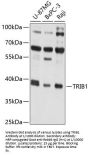 Tribbles Pseudokinase 1 (TRIB1) Antibody