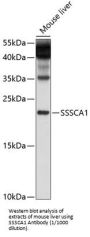 Sjogren Syndrome/Scleroderma Autoantigen 1 (SSSCA1) Antibody