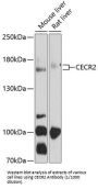 Cat Eye Syndrome Critical Region Protein 2 (CECR2) Antibody
