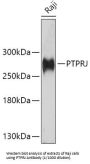 Protein Tyrosine Phosphatase Receptor Type J (PTPRJ) Antibody