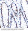 Proliferating Cell Nuclear Antigen (PCNA) Antibody
