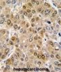 DEAD Box Polypeptide 5 (DDX5) Antibody