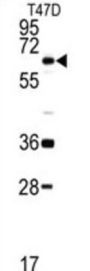 DEAD Box Polypeptide 5 (DDX5) Antibody