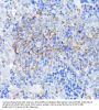 SET And MYND Domain-Containing Protein 4 (SMYD4) Antibody