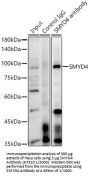 SET And MYND Domain-Containing Protein 4 (SMYD4) Antibody