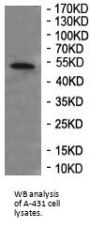 Kallikrein 10 (KLK10) Antibody
