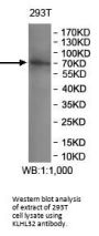 Kelch-Like Protein 32 (KLHL32) Antibody