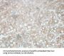 Kelch-Like Protein 32 (KLHL32) Antibody