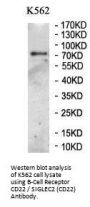 B-Cell Receptor CD22 / SIGLEC2 (CD22) Antibody