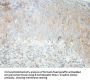 B-Cell Receptor CD22 / SIGLEC2 (CD22) Antibody