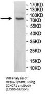 Coiled-Coil Alpha-Helical Rod Protein 1 (CCHCR1) Antibody