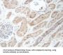 Coiled-Coil Alpha-Helical Rod Protein 1 (CCHCR1) Antibody