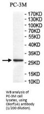 Chromosome 6 Open Reading Frame 141 (C6orf141) Antibody