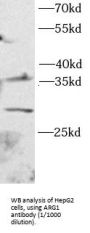 Arginase 1 (ARG1) Antibody