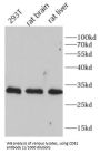 Cluster of Differentiation 81 (CD81) Antibody