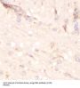 Cluster of Differentiation 81 (CD81) Antibody