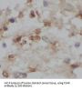 Follicle Stimulating Hormone Receptor (FSHR) Antibody