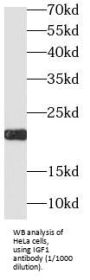 Insulin-Like Growth Factor I (IGF1) Antibody