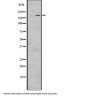 Low Density Lipoprotein Receptor Related Protein 6 (LRP6) Antibody