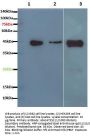 TATA Box Binding Protein (TBP) Antibody