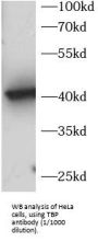 TATA Box Binding Protein (TBP) Antibody