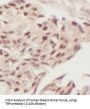 TATA Box Binding Protein (TBP) Antibody