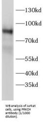 Protein Kinase C Eta Type (PRKCH) Antibody