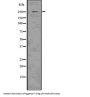 Aggrecan Core Protein (ACAN) Antibody