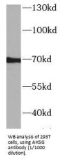 Alpha 2-HS Glycoprotein (AHSG) Antibody