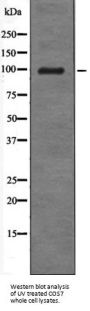 Androgen Receptor Phospho-Tyr534 (AR pY534) Antibody