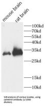 Calretinin (CALB2) Antibody