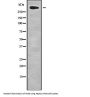 Chromodomain-Helicase-DNA-Binding Protein 8 (CHD8) Antibody