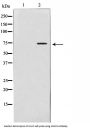Matrix Metalloproteinase 2 (MMP2) Antibody